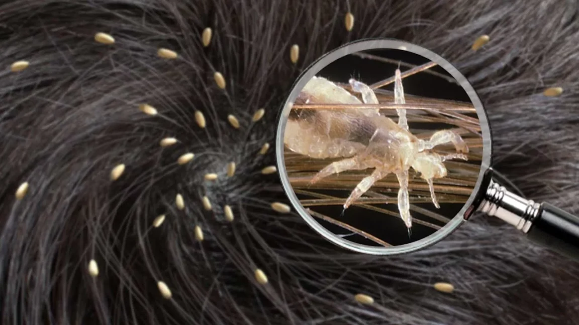 combien de temps un pou peut-il survivre sur un oreiller